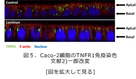 レンチナンの抗炎症効果