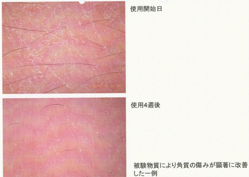 写真１　皮膚表面画像解析　改善例