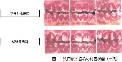 お茶の成分で口腔ケア!「カテキン」の歯垢付着抑制効果