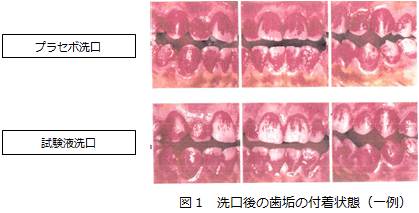 お茶の成分で口腔ケア！「カテキン」の歯垢付着抑制効果