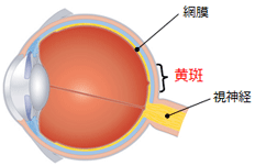 「加齢黄斑変性」って？