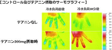 L-テアニンの冷え性改善効果について